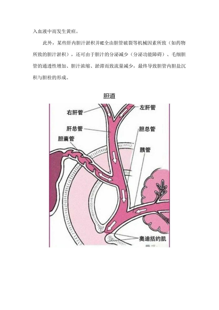 黄疸的分类及发生机制.docx_第3页