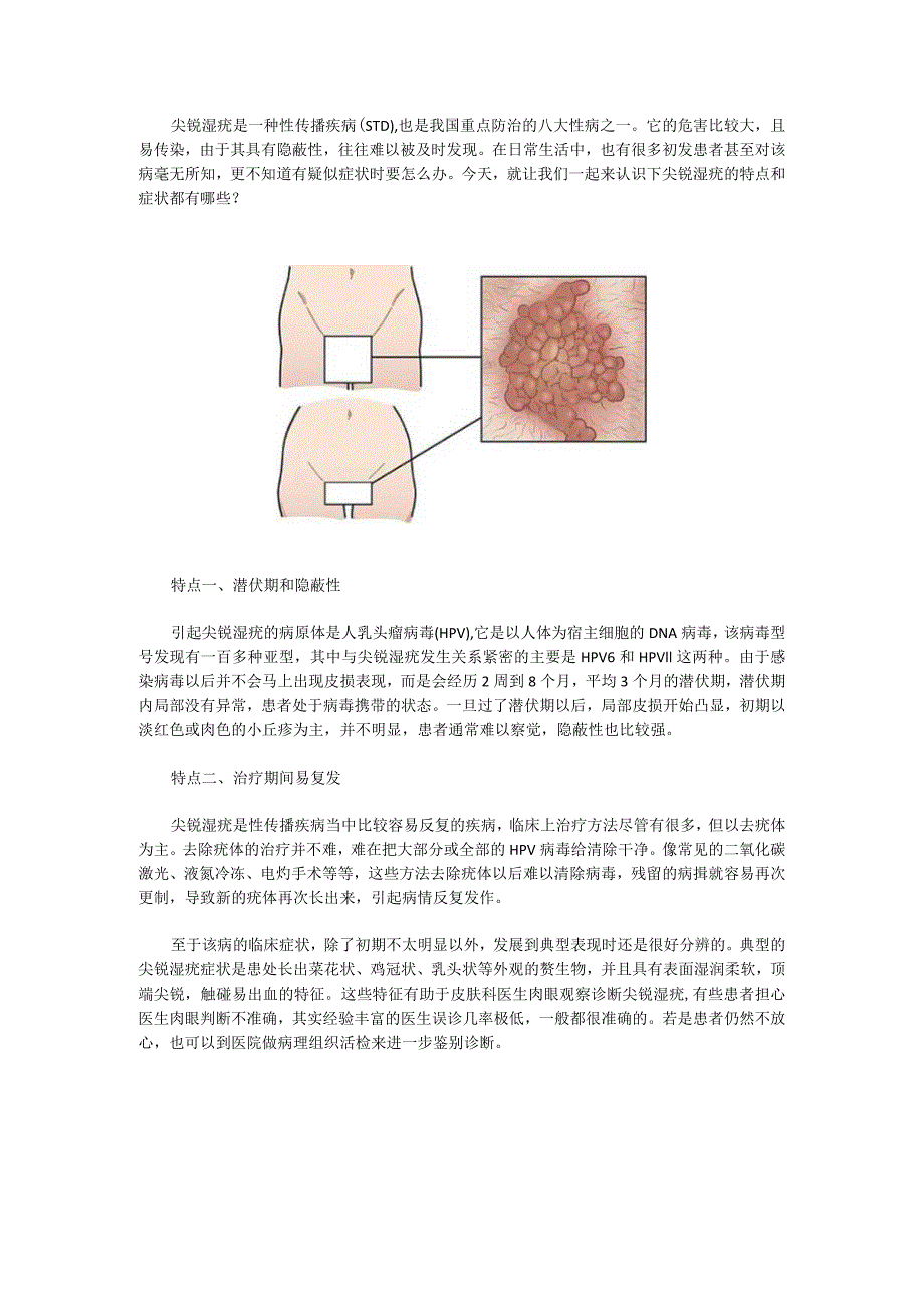 尖锐湿疣的特点和症状.docx_第1页