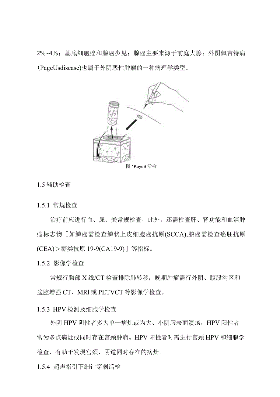 外阴恶性肿瘤诊断和治疗指南.docx_第3页