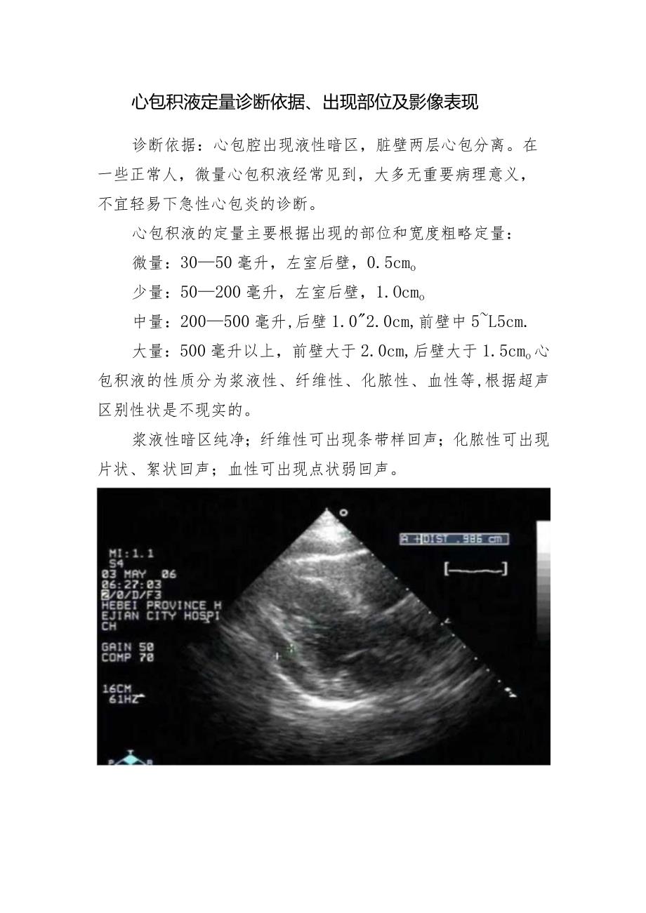 心包积液定量诊断依据、出现部位及影像表现.docx_第1页