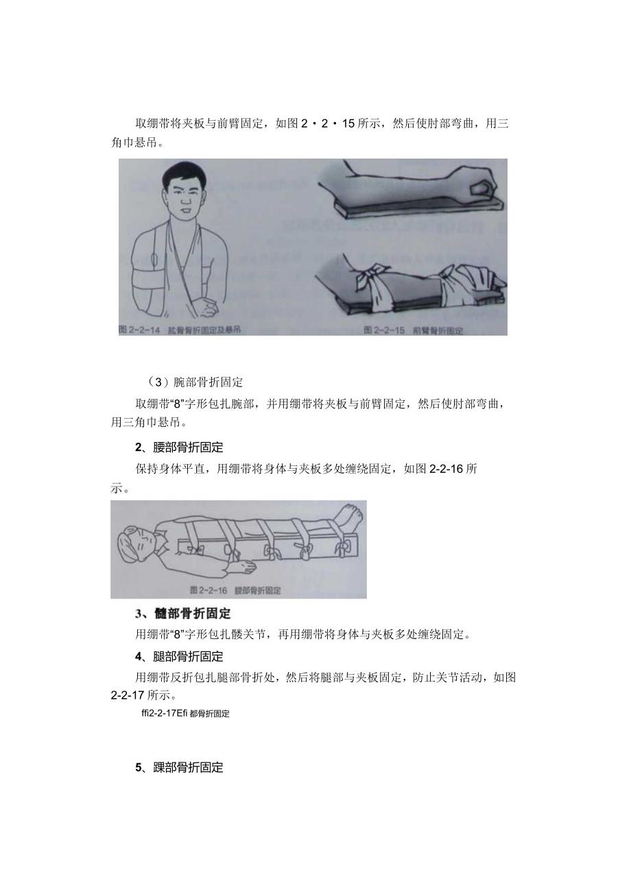 养老护理员——配合医护人员对骨折老年人的应急处理.docx_第3页