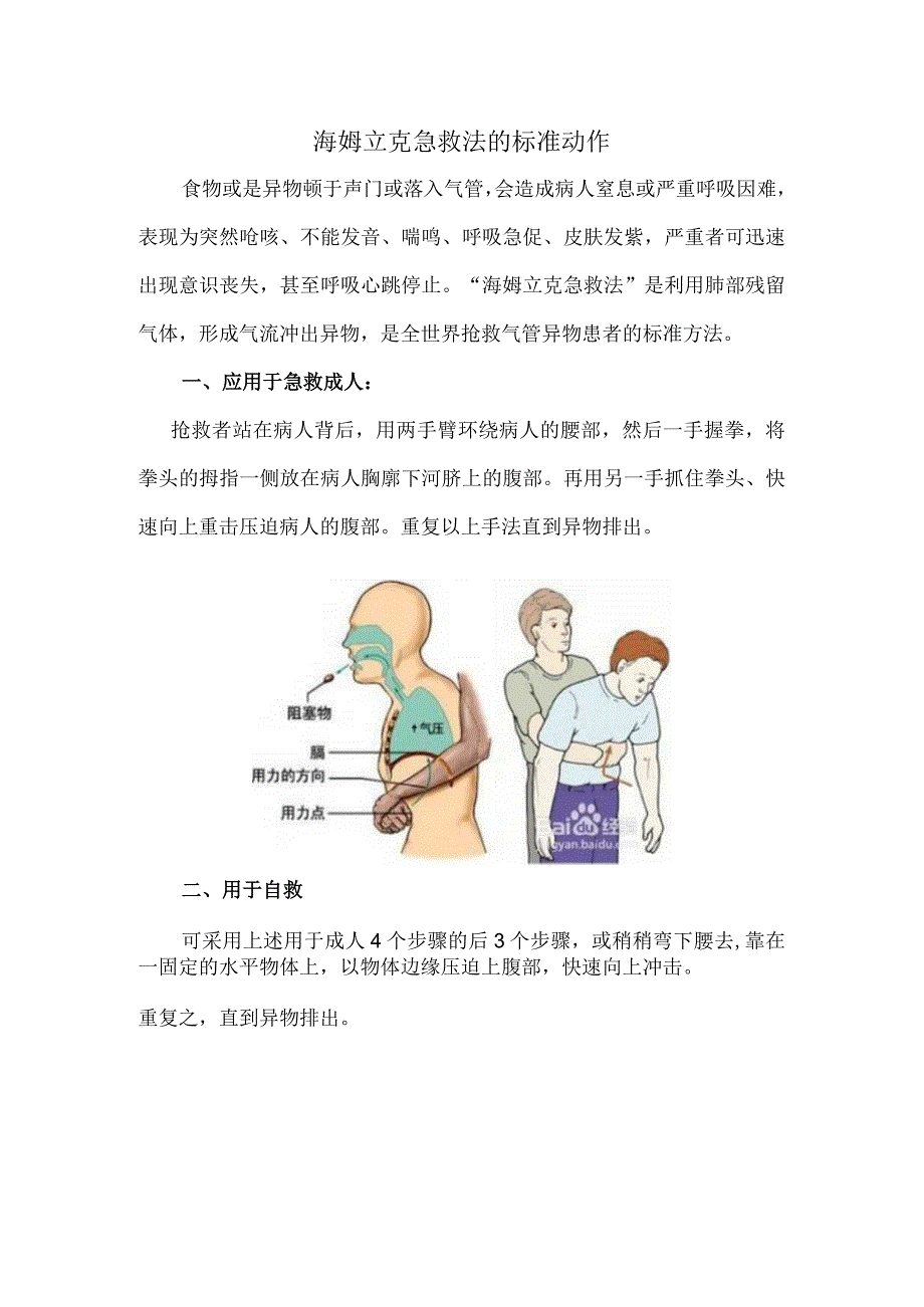 海姆立克急救法的标准动作.docx_第1页