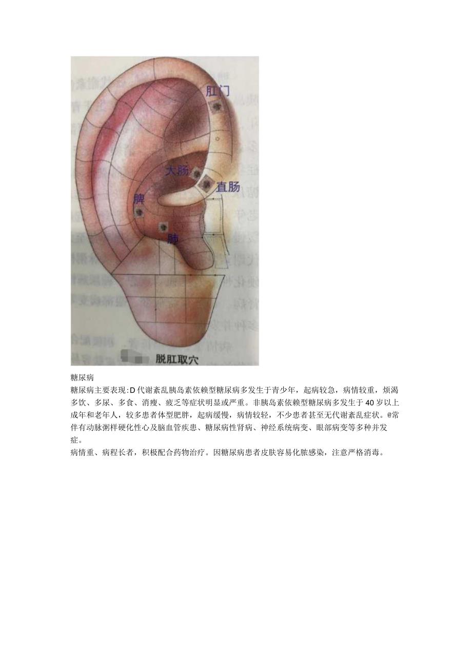 2.1耳穴调理糖尿病偏瘫甲亢.docx_第2页