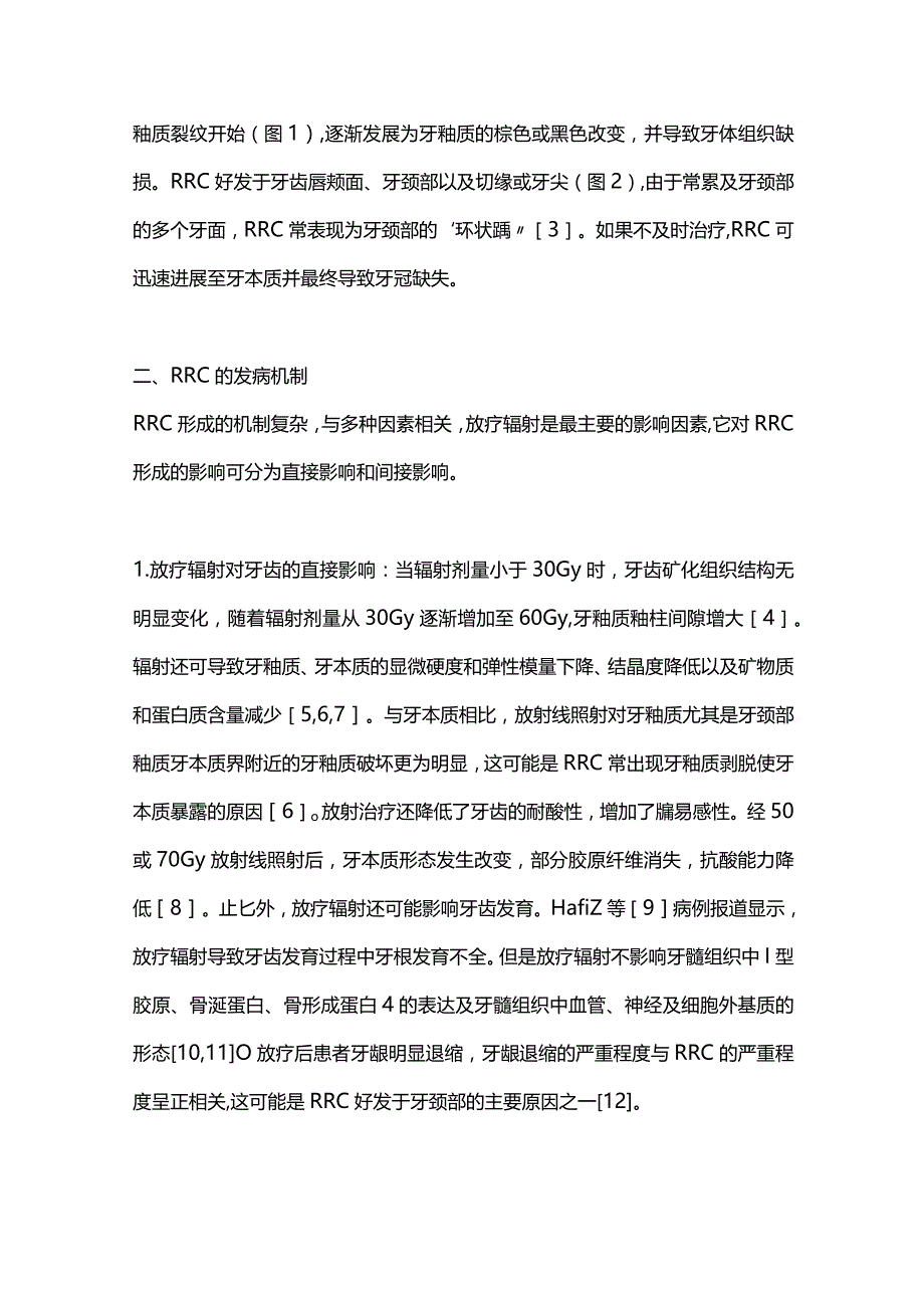 2024放射性龋的发病机制及诊疗要点.docx_第2页