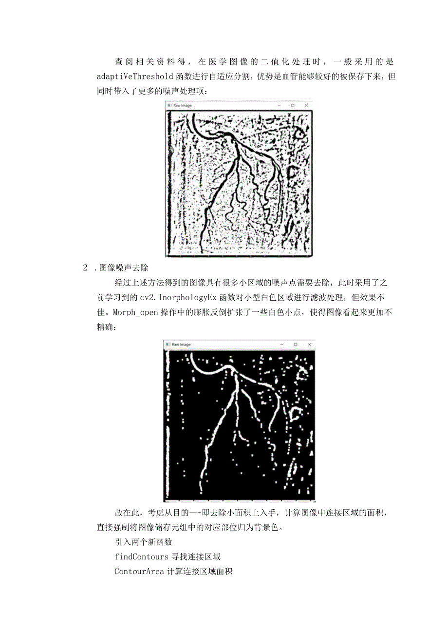 心脏造影血管提取.docx_第2页