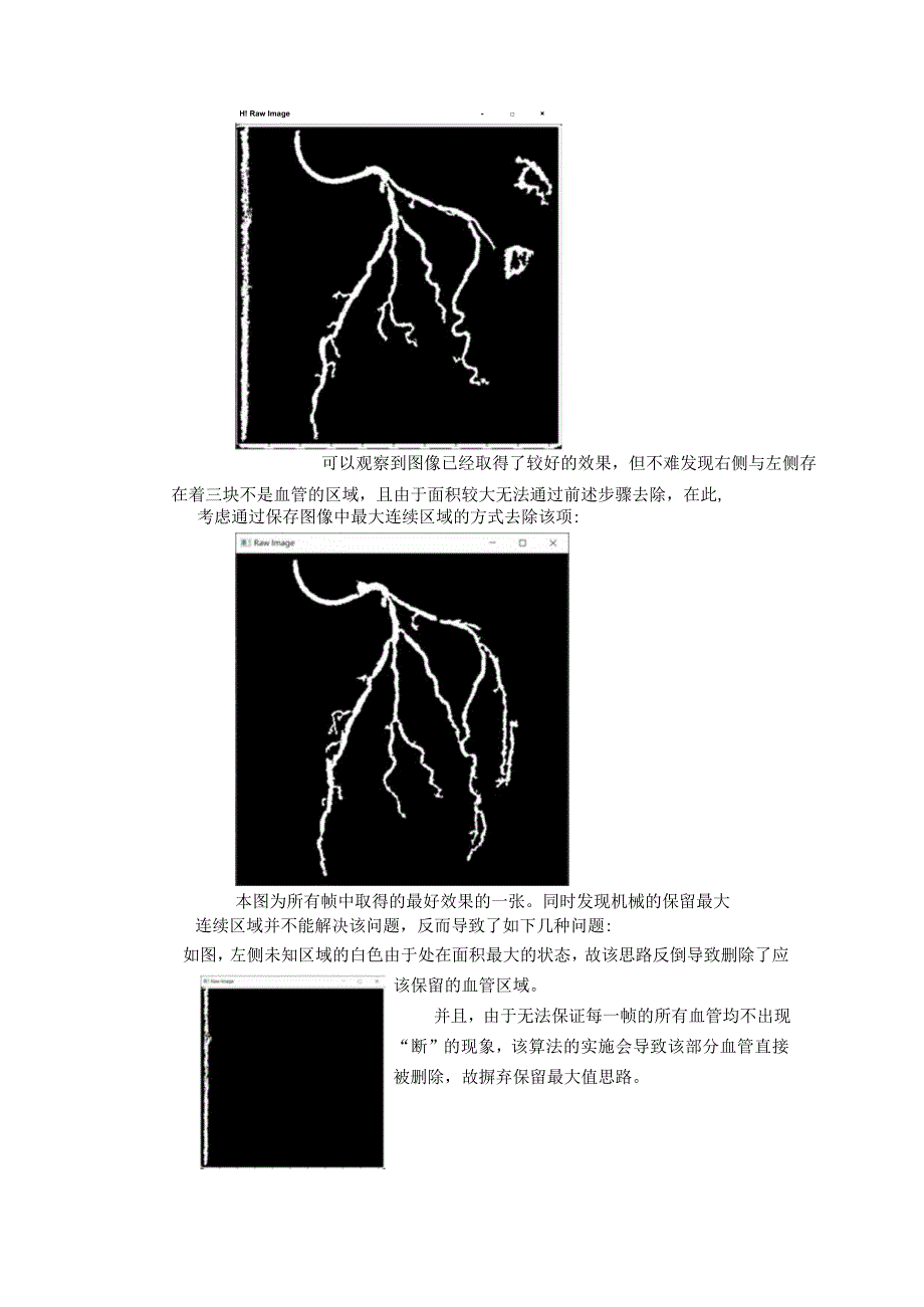 心脏造影血管提取.docx_第3页