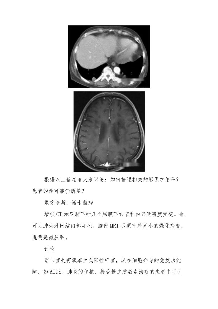 放射科医师晋升副主任医师病例分析专题报告（胸部CT异常病例）.docx_第3页