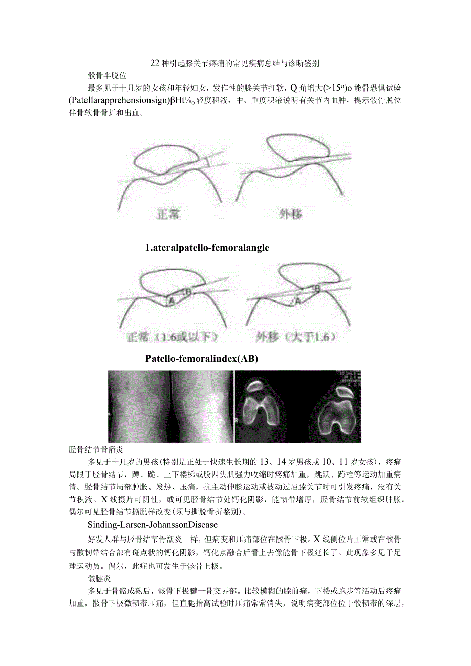 22种引起膝关节疼痛的常见疾病总结与诊断鉴别.docx_第1页