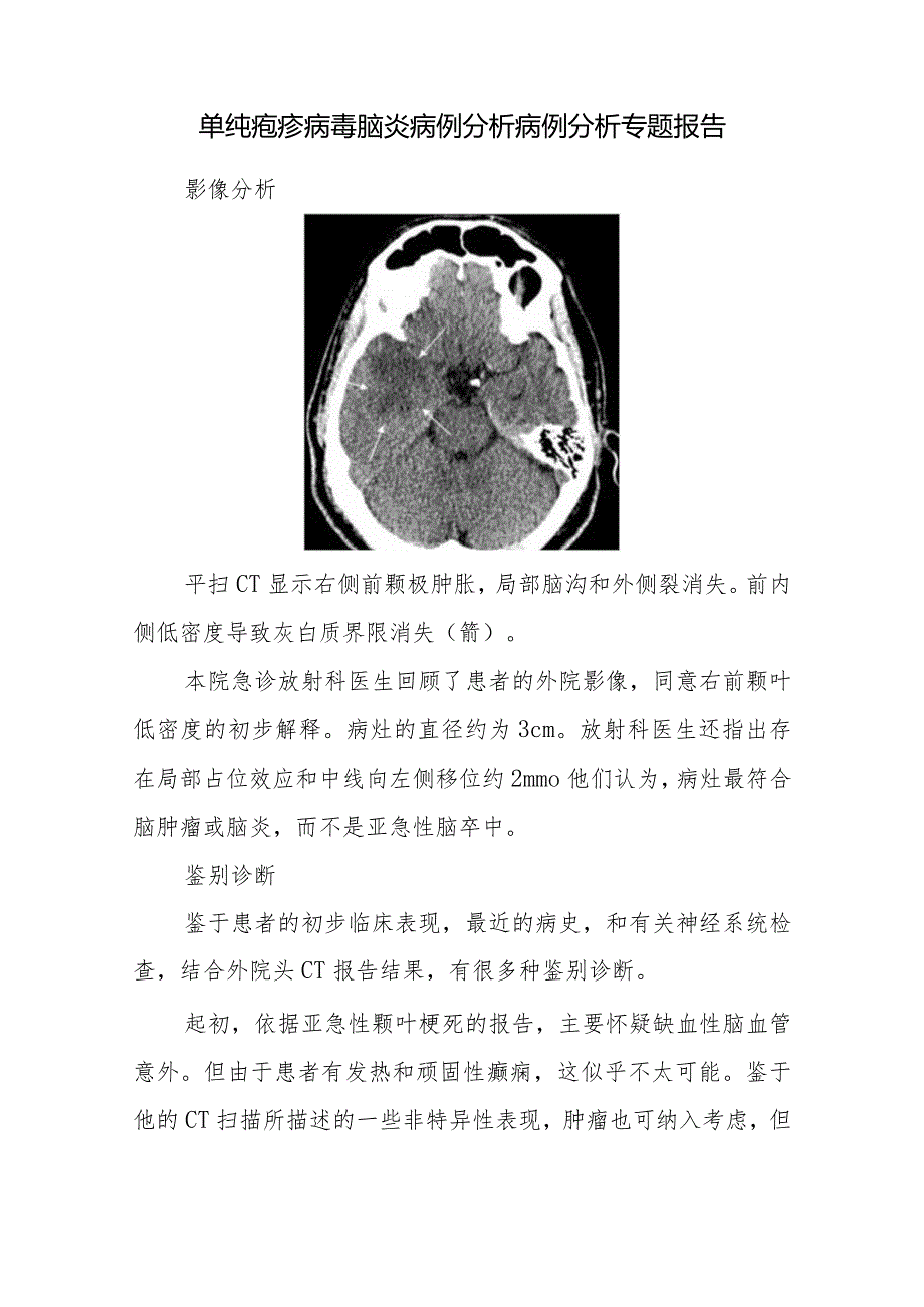 脑病科医师晋升副主任医师病例分析专题报告（单纯疱疹病毒脑炎）.docx_第2页