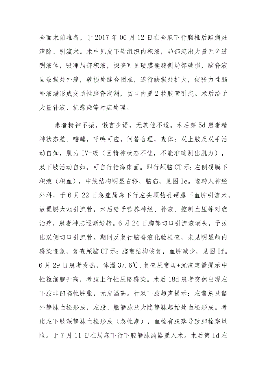 脊柱外科胸椎间盘突出症术后多种并发症病例分析专题报告.docx_第3页