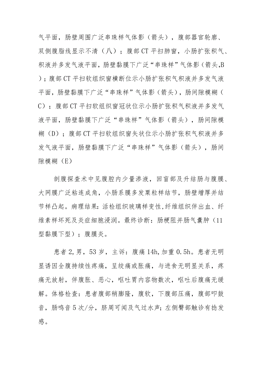 放射科肠气囊肿症影像表现病例分析专题报告.docx_第2页