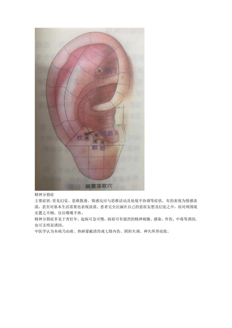 2.18耳穴 眩晕 神经衰弱.docx_第2页