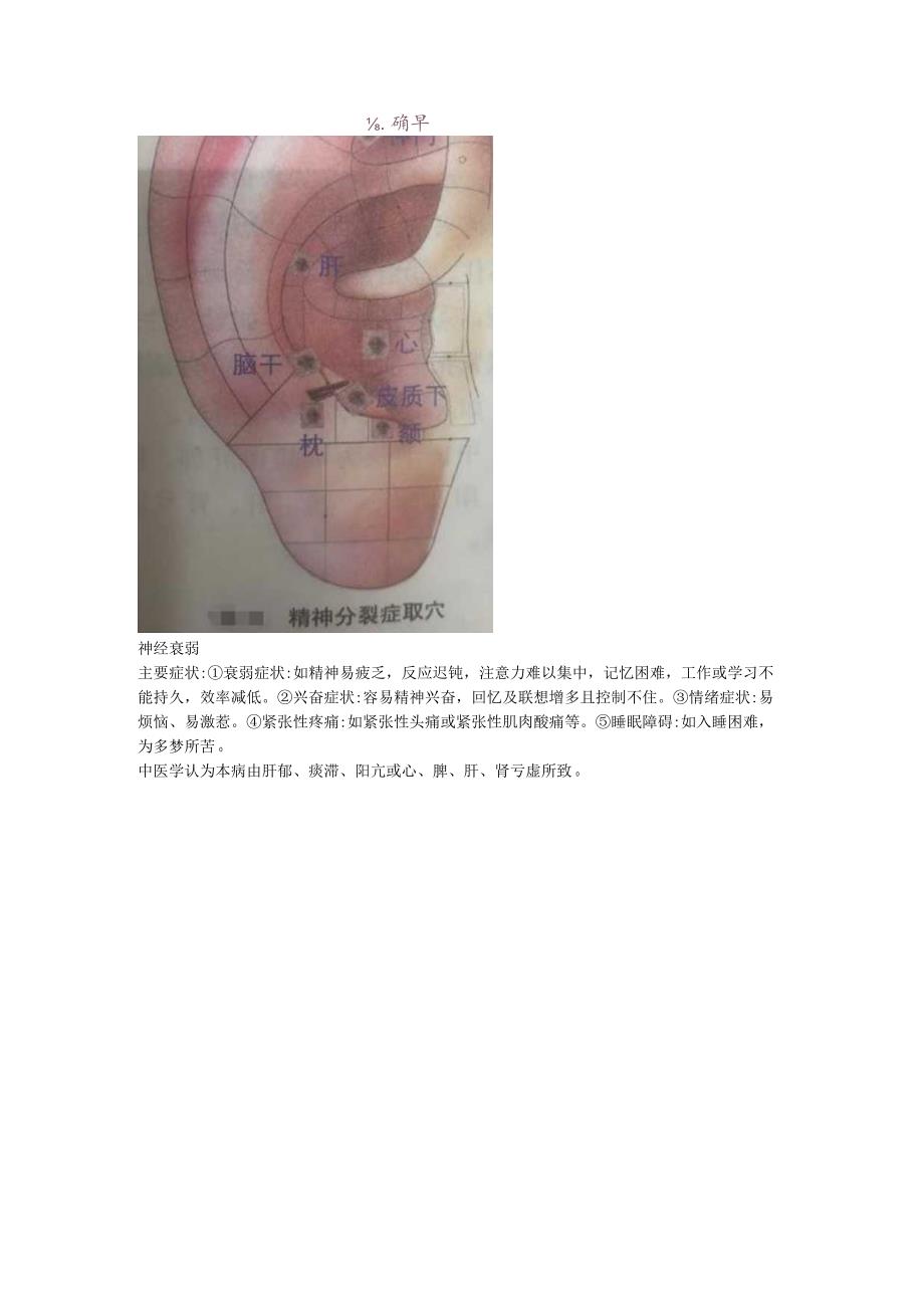 2.18耳穴 眩晕 神经衰弱.docx_第3页