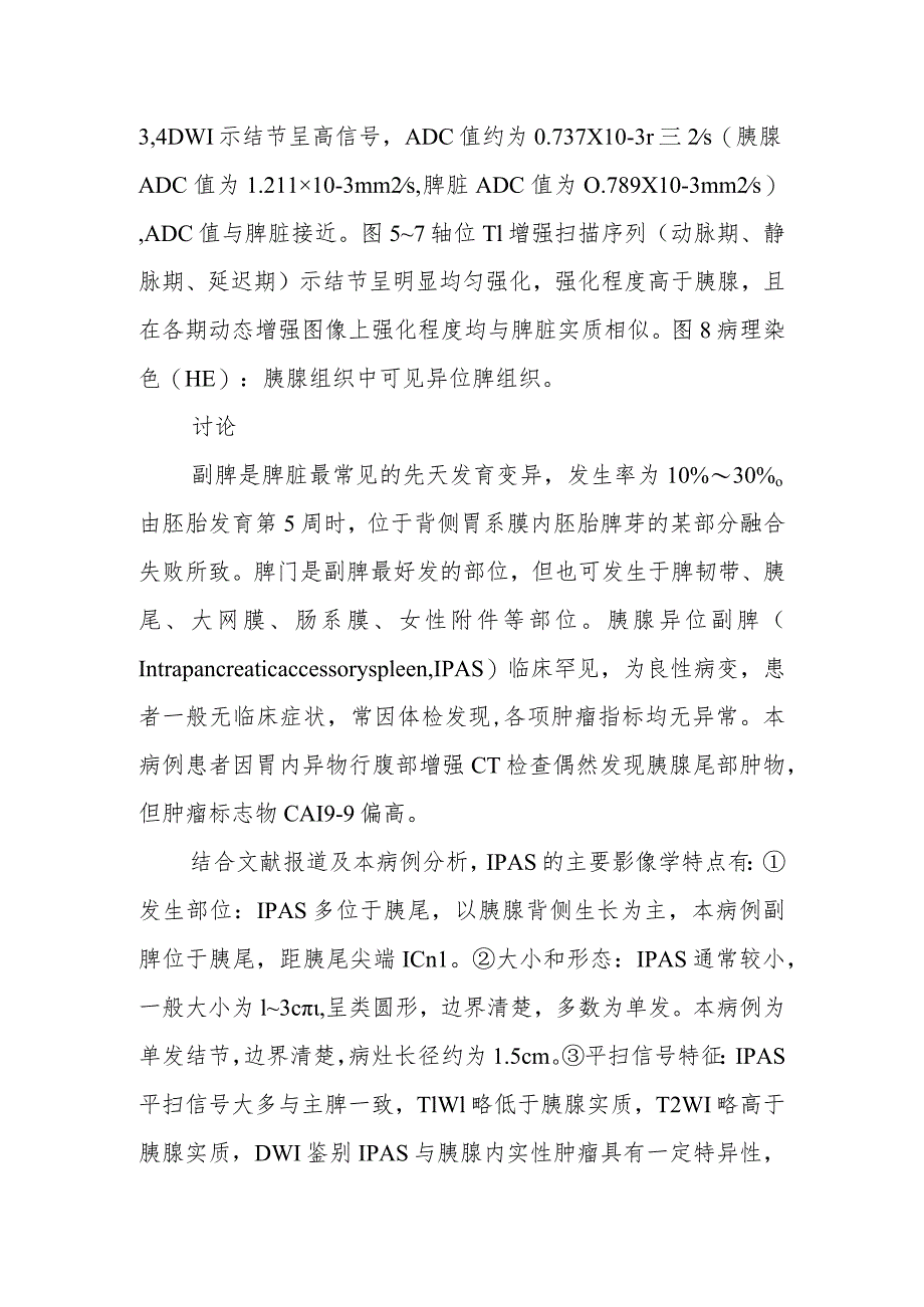 消化内科医师晋升副主任医师病例分析专题报告（胰腺异位副脾病例）.docx_第3页