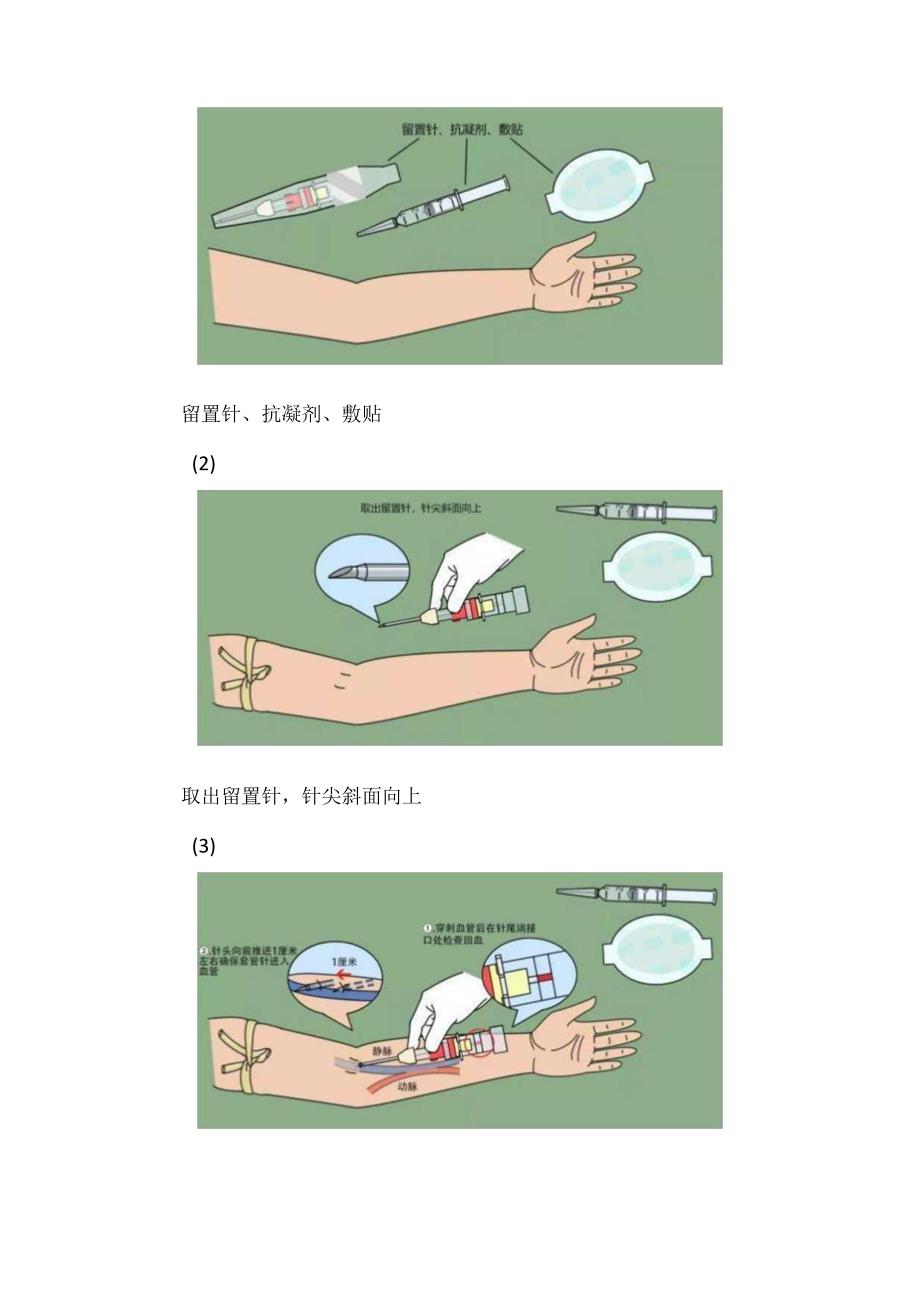 透析用留置针在血液净化中的标准化使用流程.docx_第2页