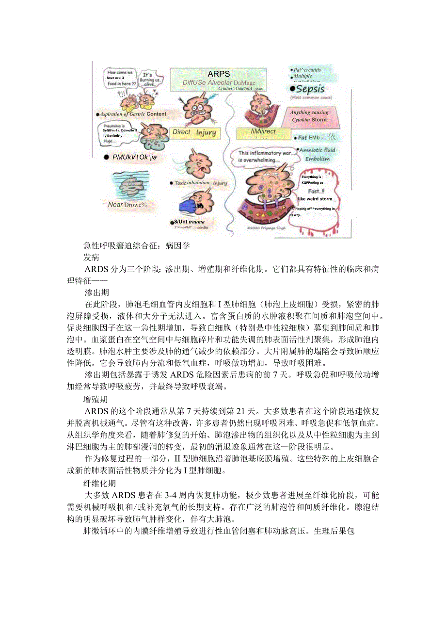 ARDS（急性呼吸窘迫综合征）新手入门(课件).docx_第2页