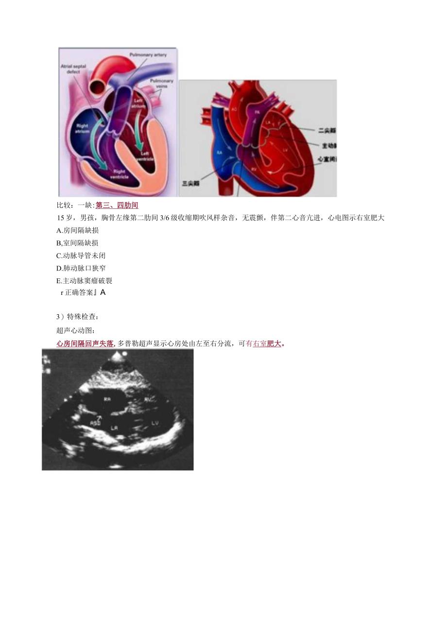 心血管内科主治医师资格笔试专业实践能力考点解析 (5)：先天性心血管病.docx_第2页