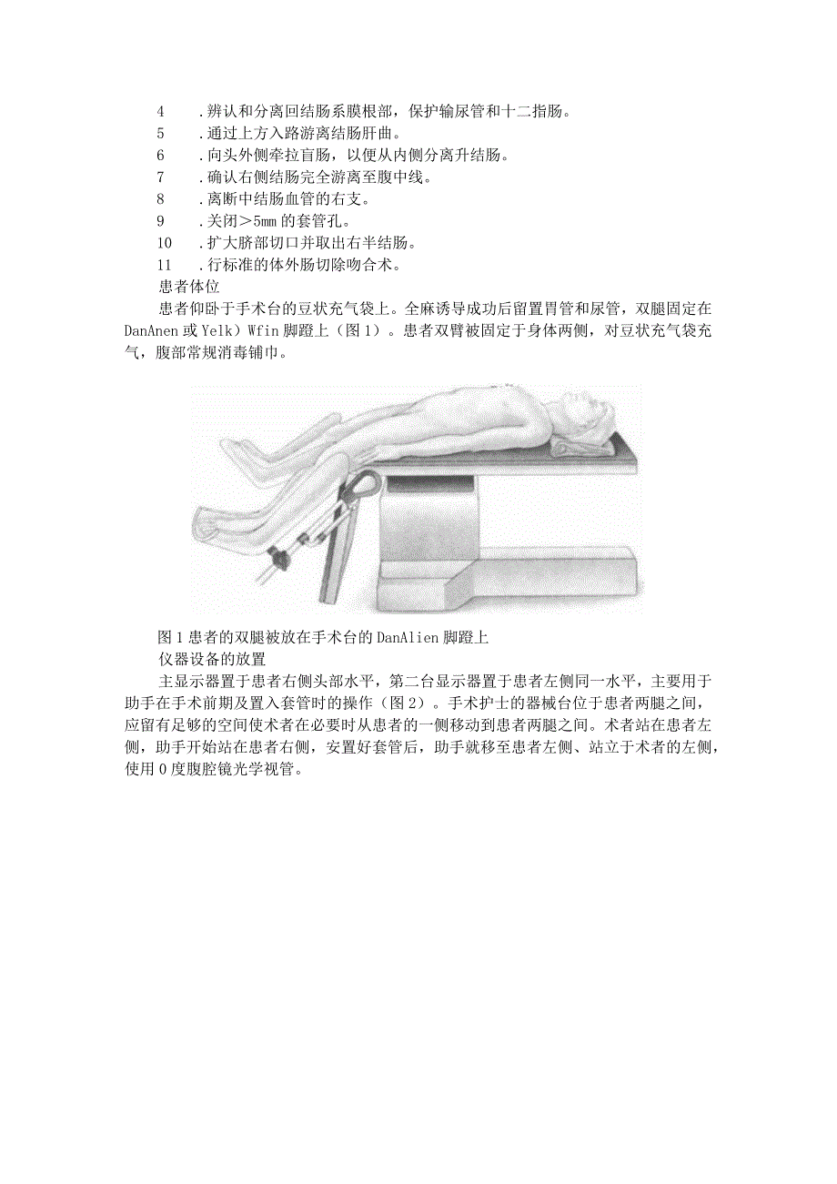 (术中要点与技巧)腹腔镜右半结肠切除术.docx_第2页