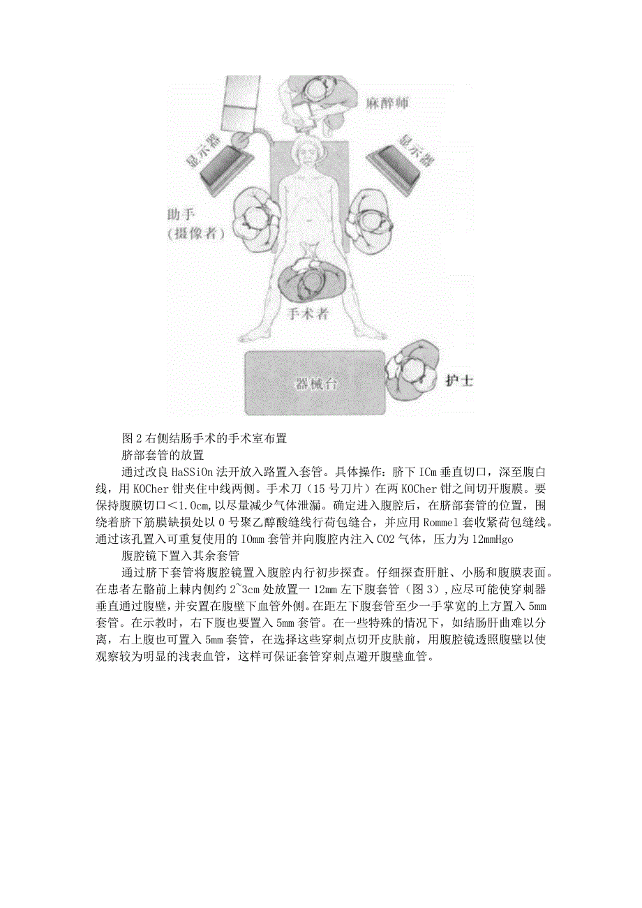 (术中要点与技巧)腹腔镜右半结肠切除术.docx_第3页