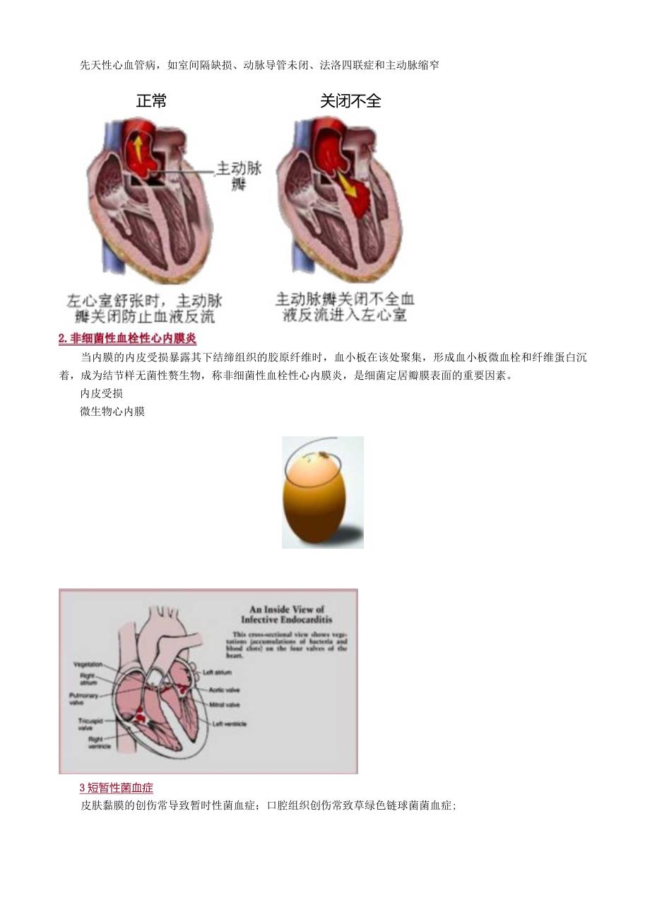 心血管内科主治医师资格笔试专业知识考点解析 (8)：感染性心内膜炎.docx_第2页