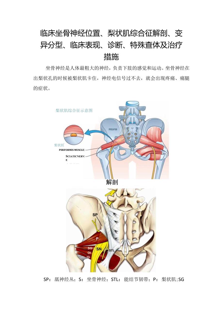 临床坐骨神经位置、梨状肌综合征解剖、变异分型、临床表现、诊断、特殊查体及治疗措施.docx_第1页