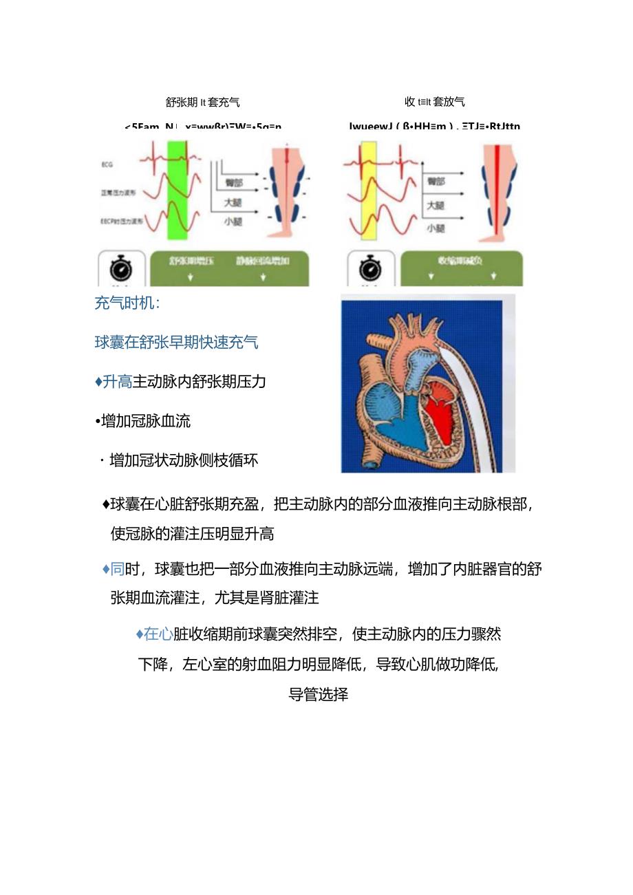 临床主动脉球囊反搏术工作原理、导管选择、适应症、禁忌症、并发症及注意事项.docx_第3页