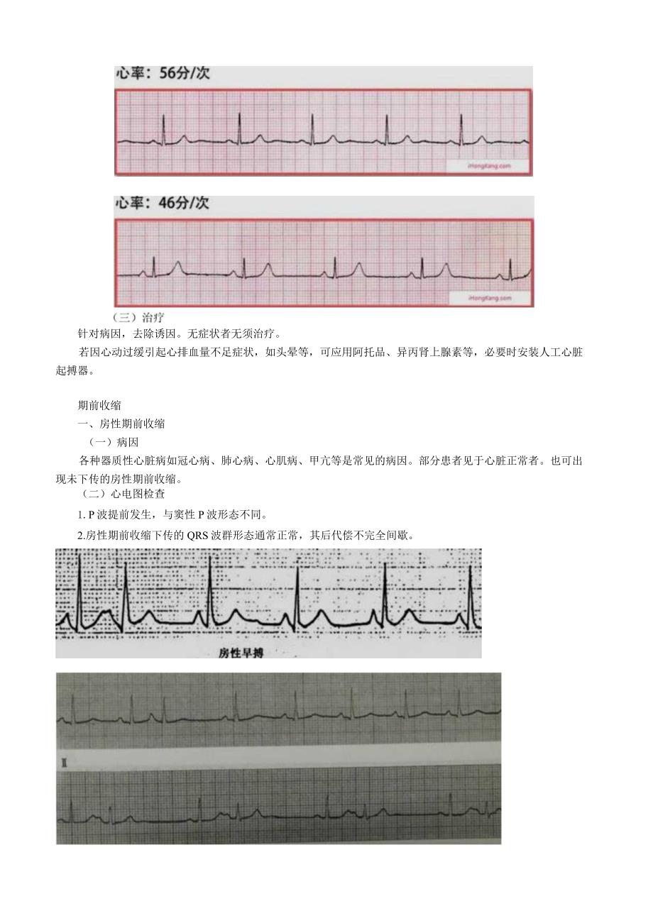 心血管内科主治医师资格笔试冲刺考点解析 ：专业实践能力.docx_第2页