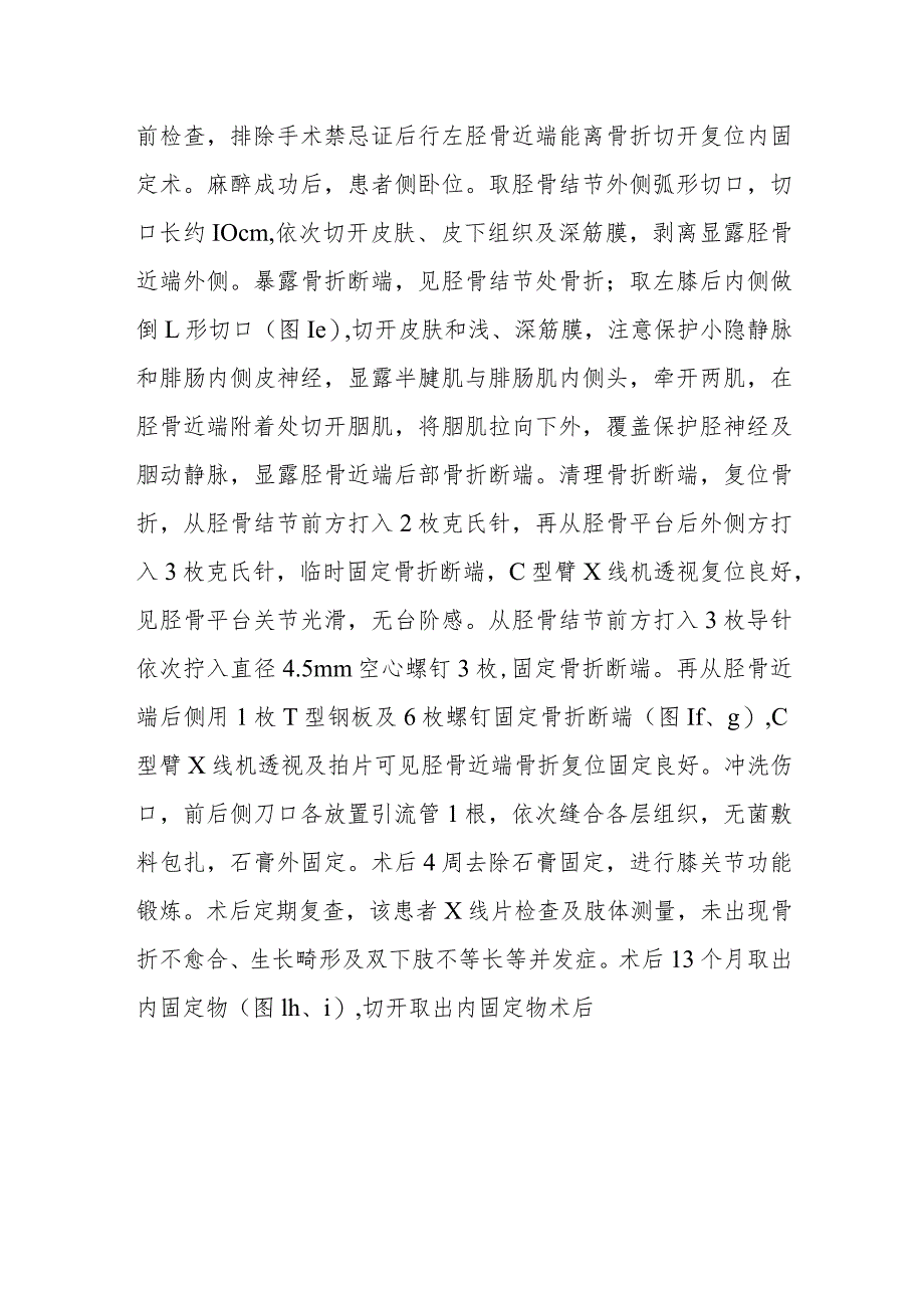 骨外科儿童胫骨近端三平面骨骺骨折病例分析专题报告.docx_第2页