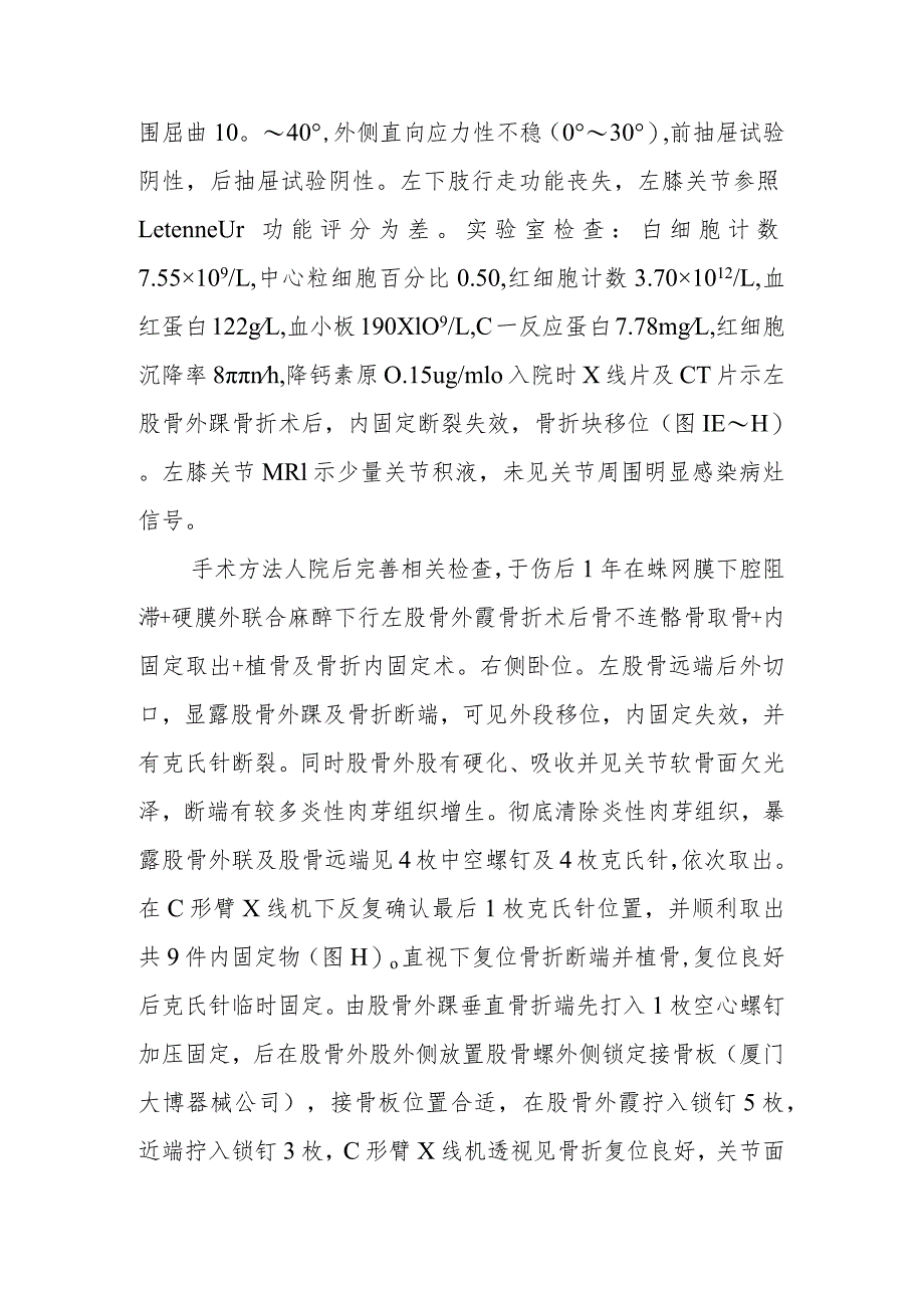 骨外科陈旧性Hoffa骨折翻修病例分析专题报告.docx_第2页