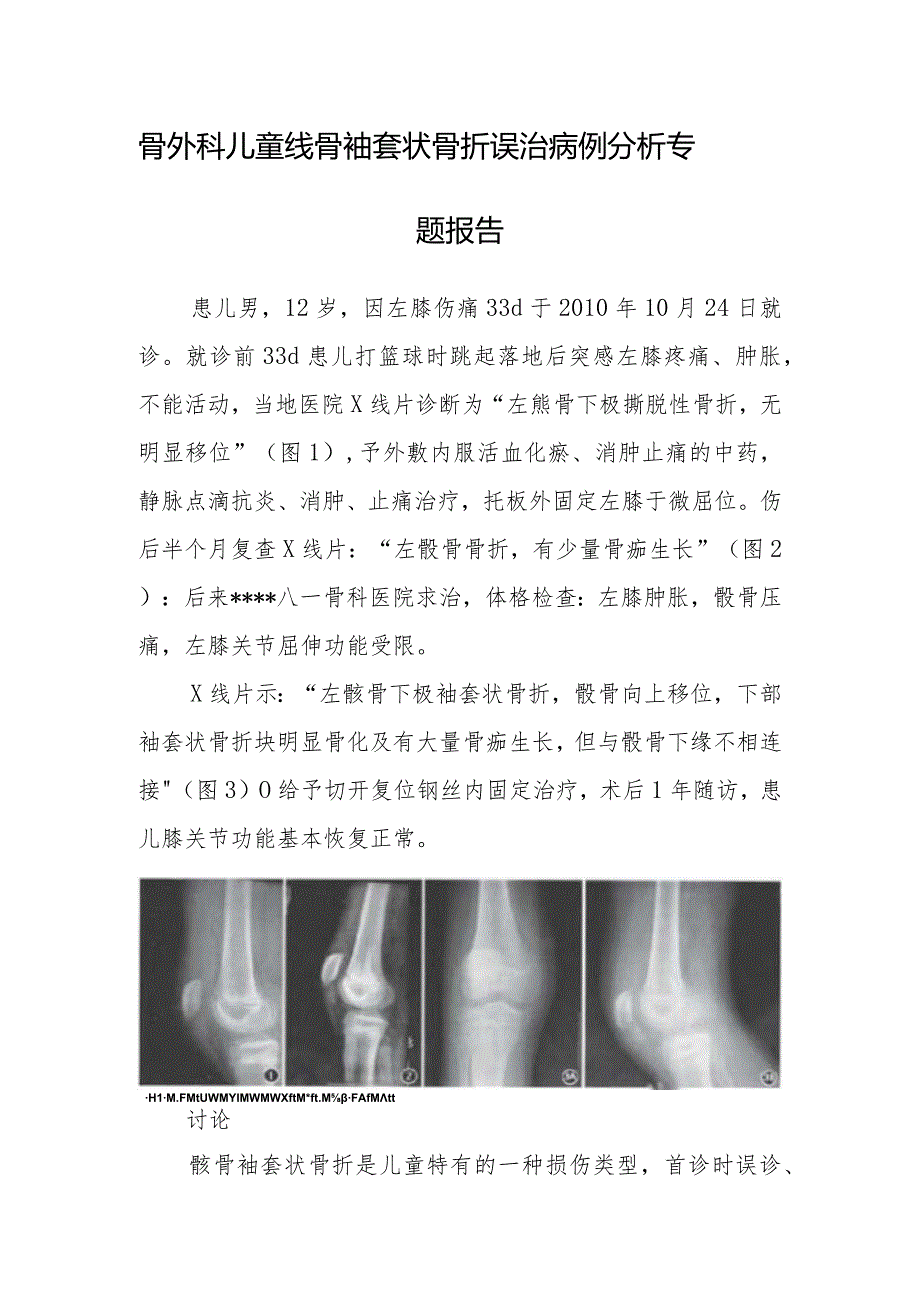 骨外科儿童髌骨袖套状骨折误治病例分析专题报告.docx_第1页