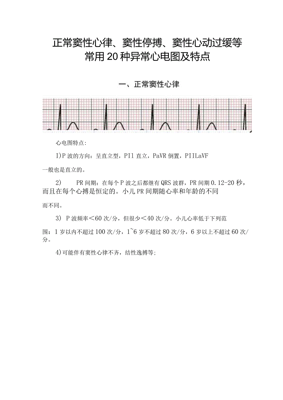 正常窦性心律、窦性停搏、窦性心动过缓等常用20种异常心电图及特点.docx_第1页