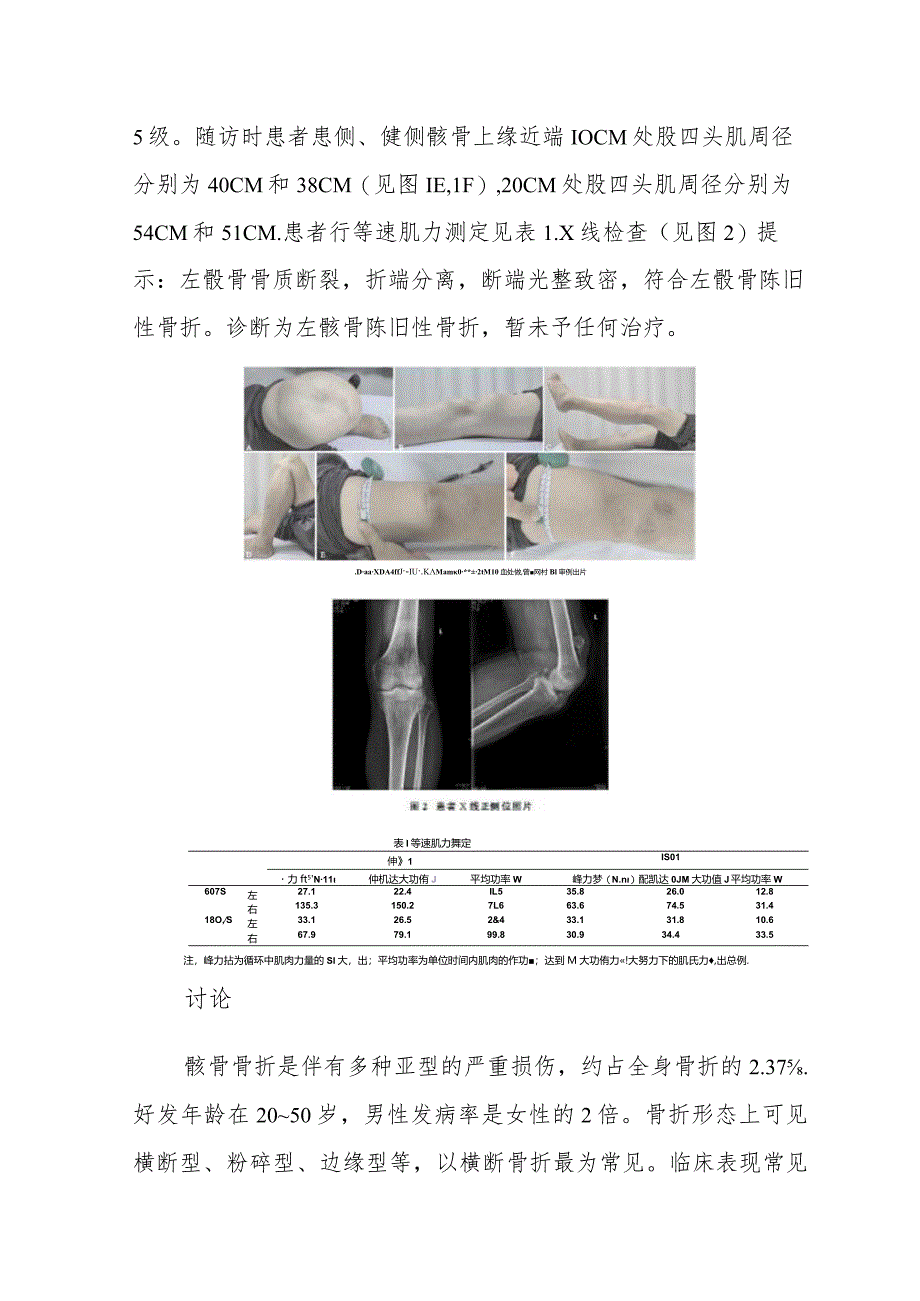 骨外科陈旧性髌骨骨折罕见病例分析专题报告.docx_第2页