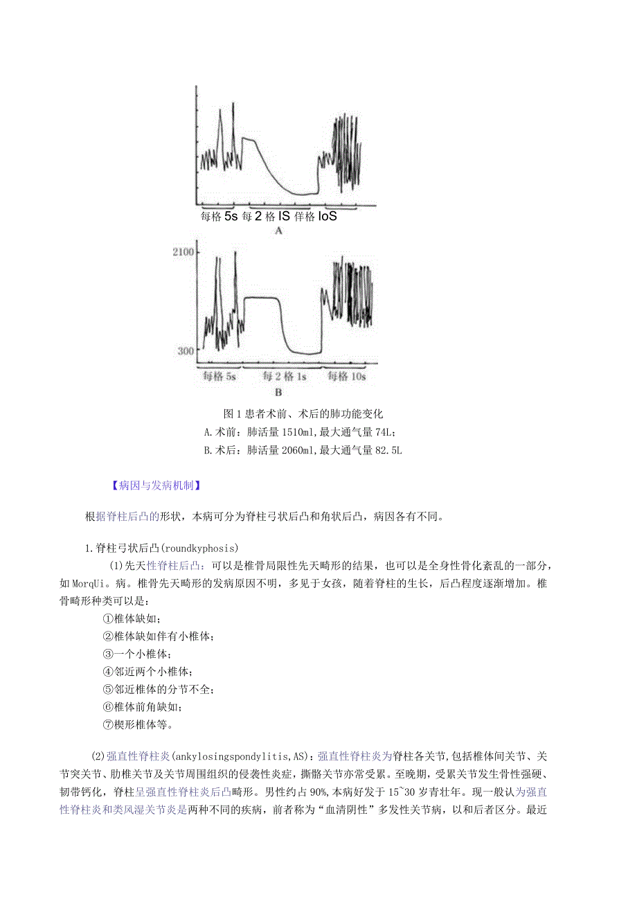 脊柱后凸讲义.docx_第2页