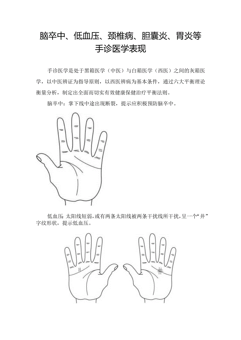 脑卒中、低血压、颈椎病、胆囊炎、胃炎等手诊医学表现.docx_第1页