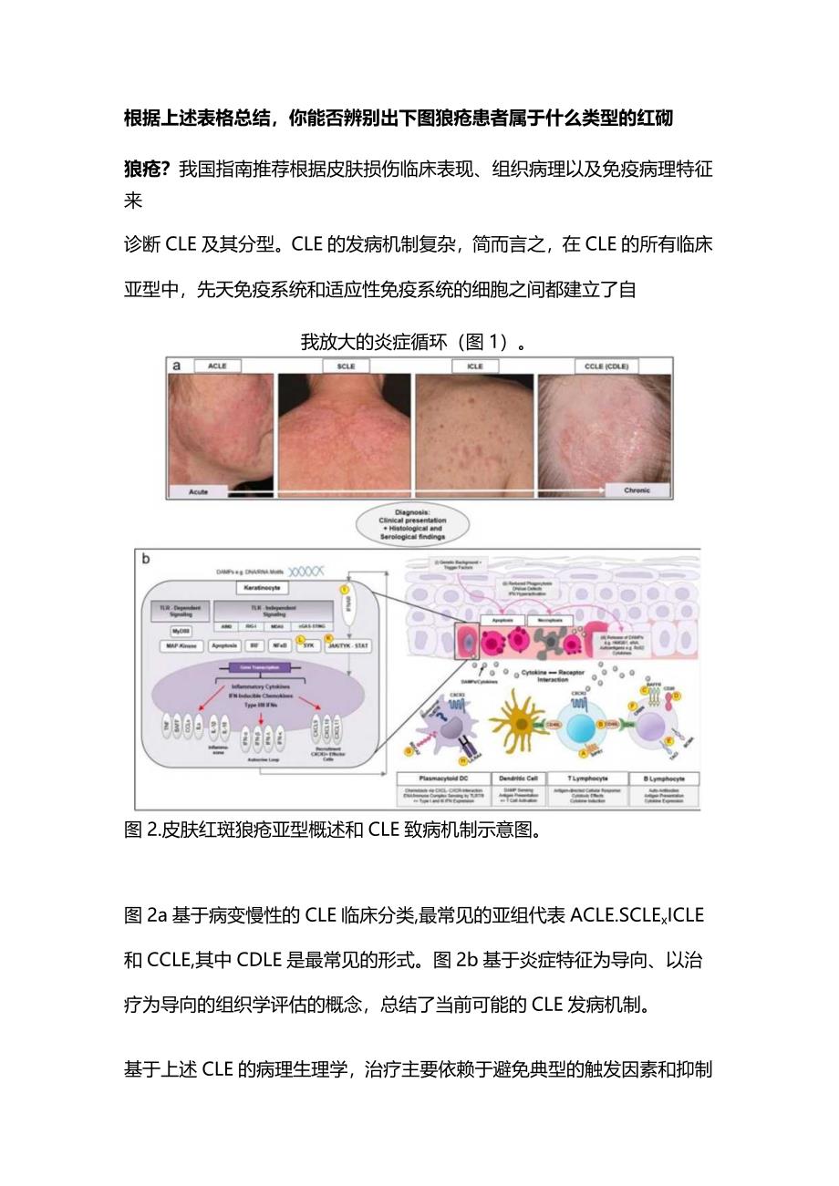 2024皮肤型红斑狼疮治疗方案.docx_第2页