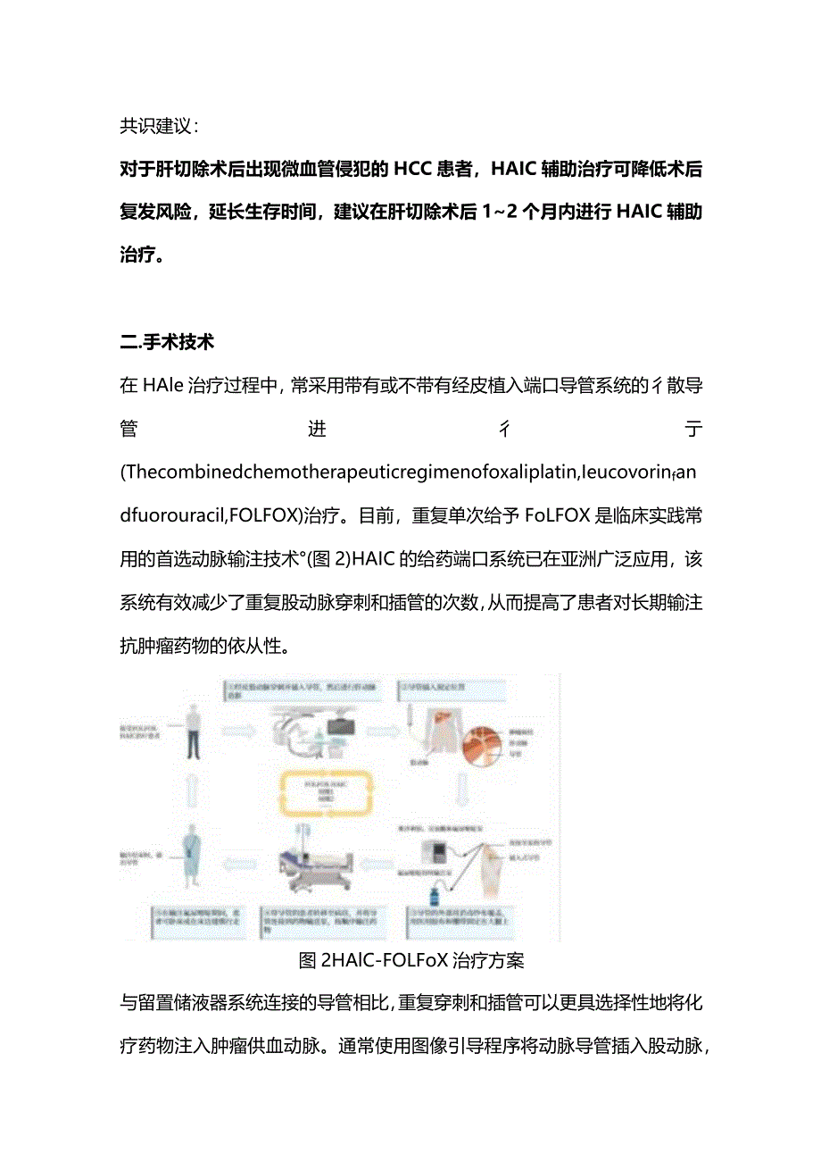 2024肝癌的动脉灌注治疗.docx_第2页