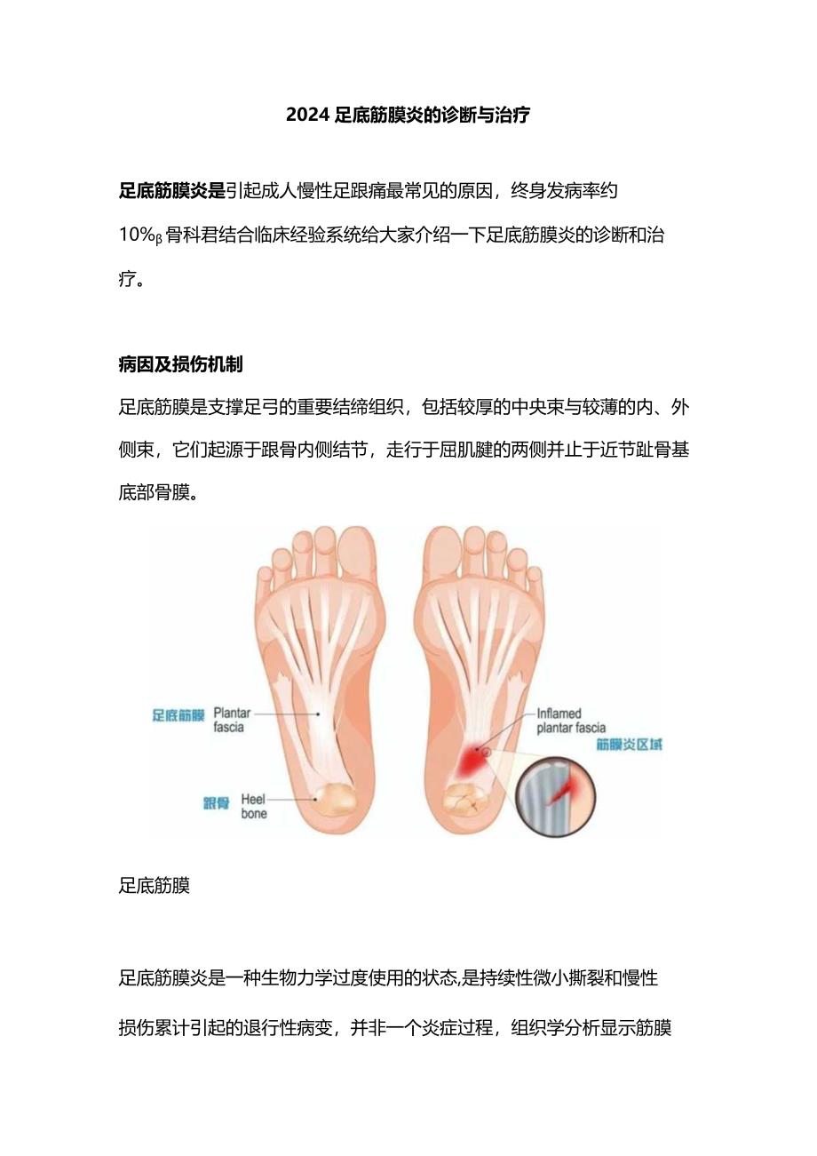 2024足底筋膜炎的诊断与治疗.docx_第1页