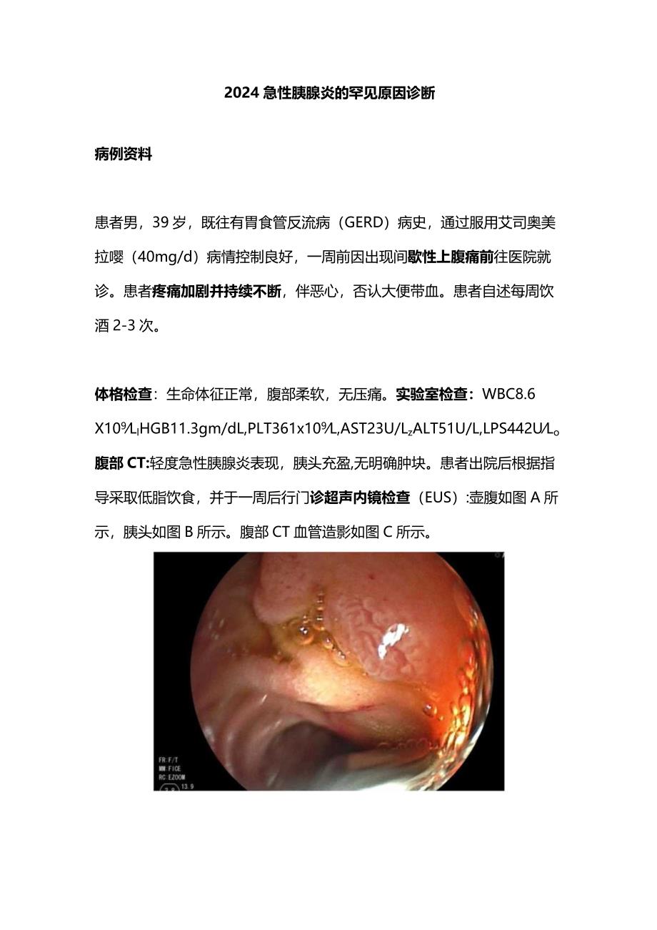 2024急性胰腺炎的罕见原因诊断.docx_第1页