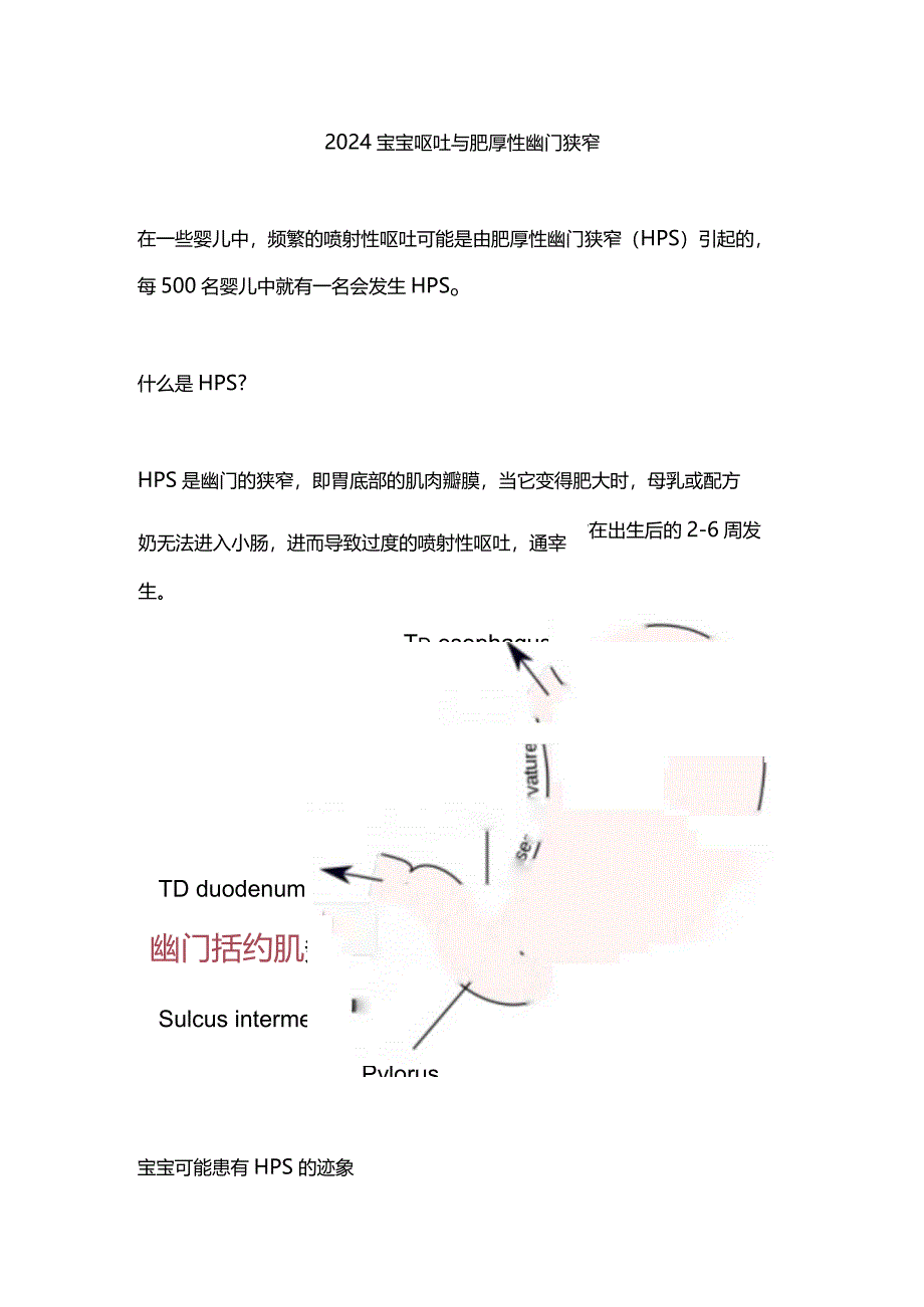 2024宝宝呕吐与肥厚性幽门狭窄.docx_第1页