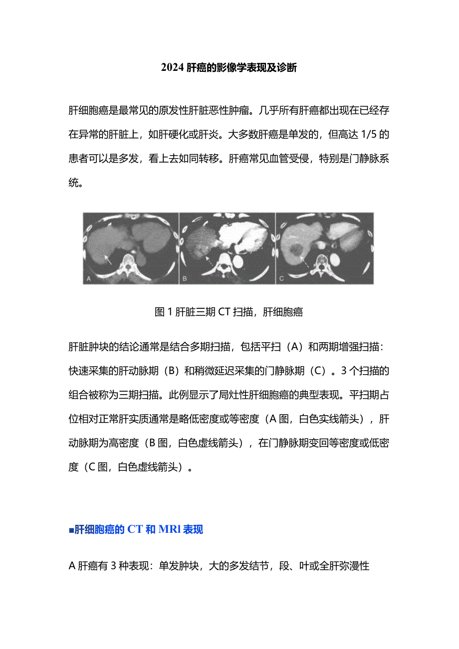 2024肝癌的影像学表现及诊断.docx_第1页