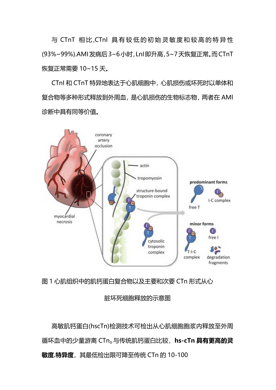 2024肌钙蛋白的临床意义.docx_第2页