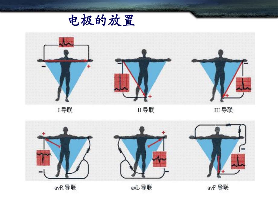 心电图的基本知识.ppt_第2页