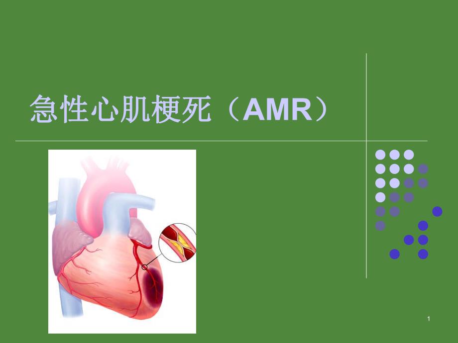 急性心肌梗死护理查房.ppt_第1页