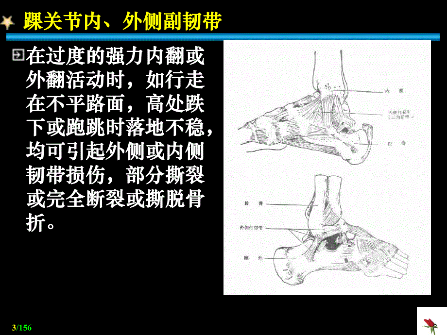 关节脱位Dislocation.ppt_第3页