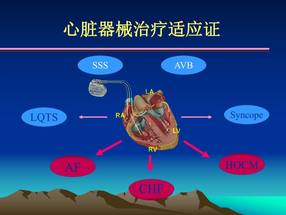 心脏植入器械国际专家共识.ppt_第3页