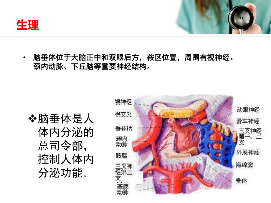 垂体瘤护理查房.ppt_第3页