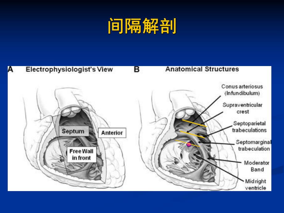 右心室间隔部起搏tool and skill.ppt_第3页