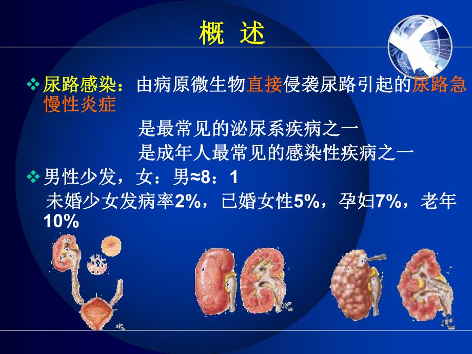 尿路感染病人护理.ppt_第3页