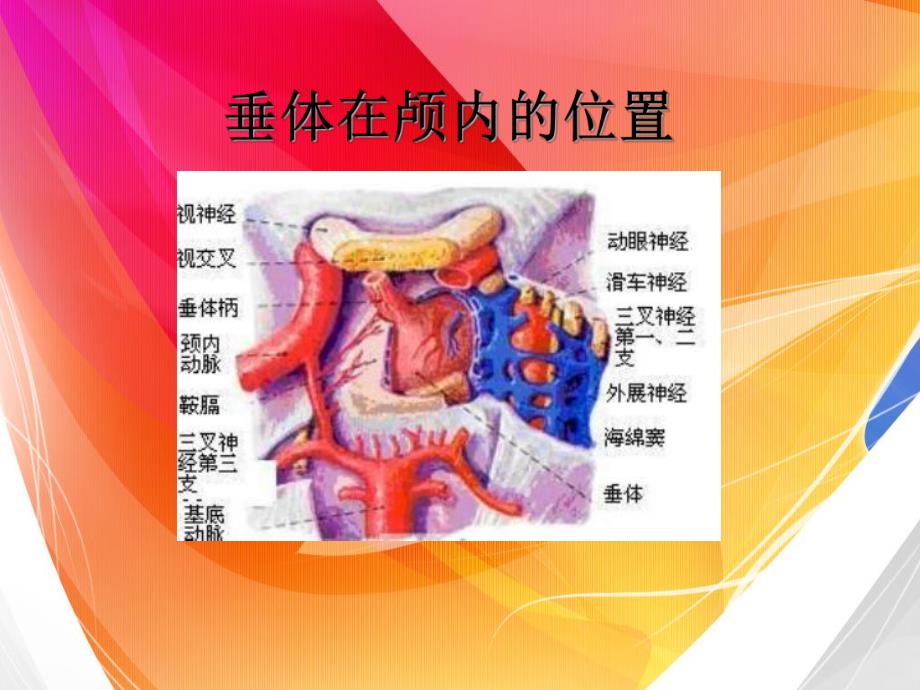 垂体腺瘤.ppt_第3页