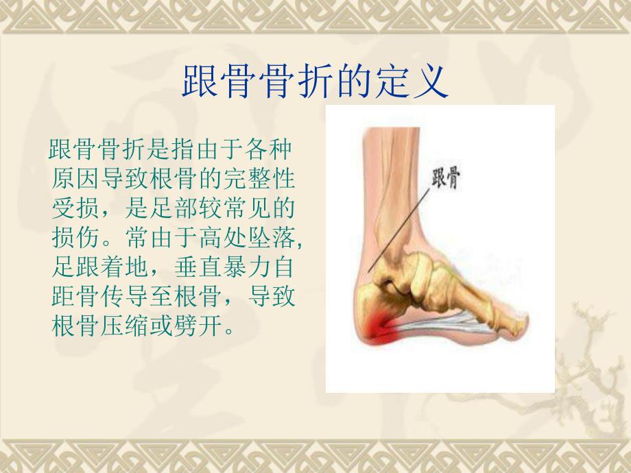 新建跟骨骨折的护理查房演示文稿.ppt_第2页